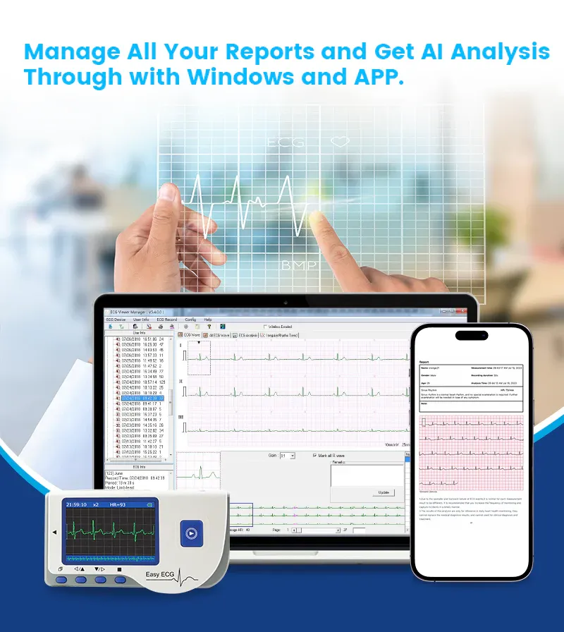 PC-80B_Compact_ECG_Machine_AI_ECG_Report.webp