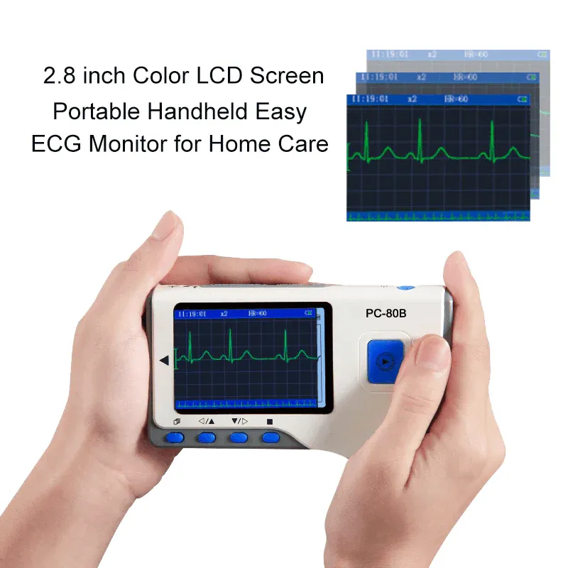 LepuPortableEasyECGMonitorPC-80BHandheldEKGHeartRateMonitorforAndroidiPhoneDailyHomeUsewithWirelessBluetoothConnectioncolorLCDscreen.webp