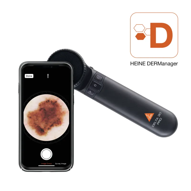 HEINE-DELTA-30-PRO-dermatoscope-3_800x800.webp
