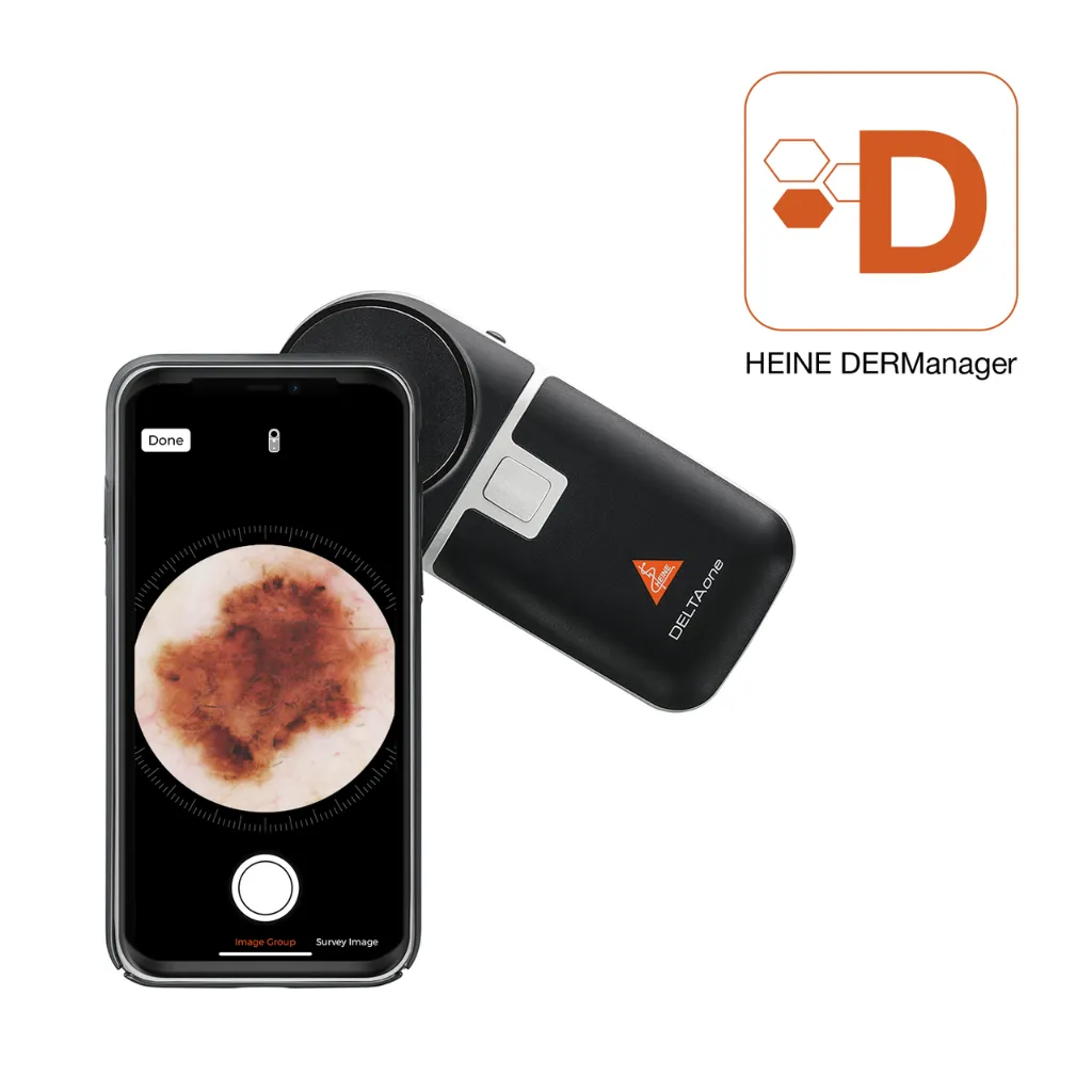 K-210.28.305-HEINE-DELTAone-dermatoscope-5_1280x1280.webp