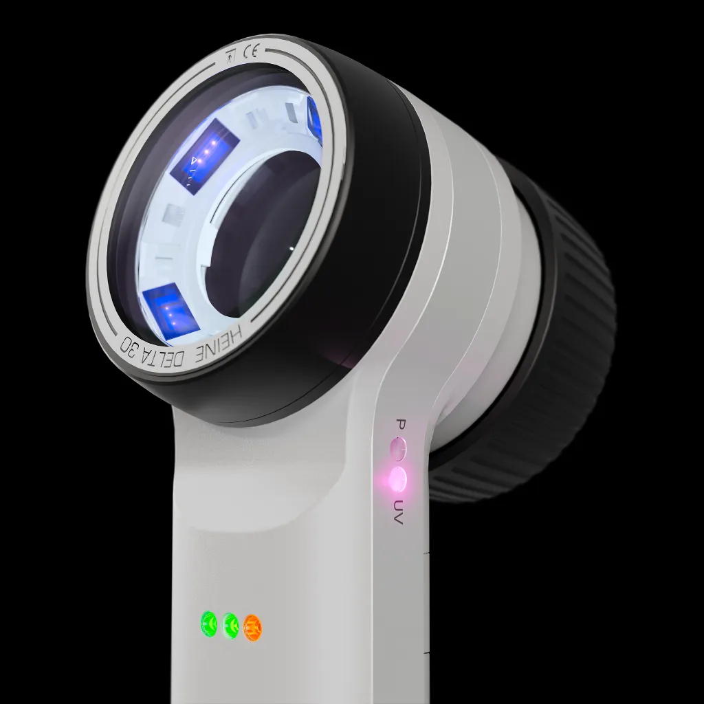 HEINE-DELTA30-UV-Dermatoscope-close-up-5.webp