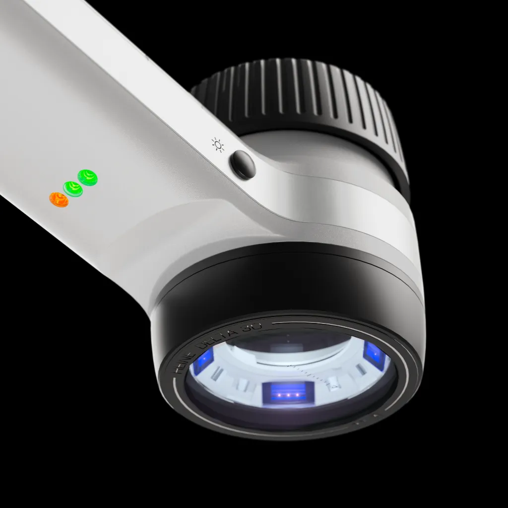 HEINE-DELTA30-UV-Dermatoscope-close-up-1.webp