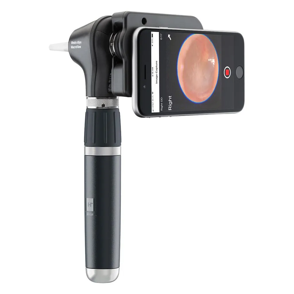 [71-xM3LxE] Otoscope Welch Allyn Macroview Plus iExaminer.webp